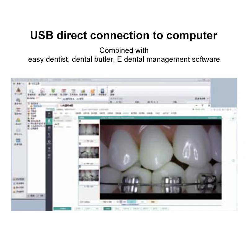 Внутриротовая камера VVDental 4K HD с матрицей CMOS 12.8, 8 светодиодами, USB-эндоскоп для осмотра зубов, автоматическая фокусировка, камера для осмотра полости рта для ПК (art.: 3920d800bc46a) - 3920d800bc46a