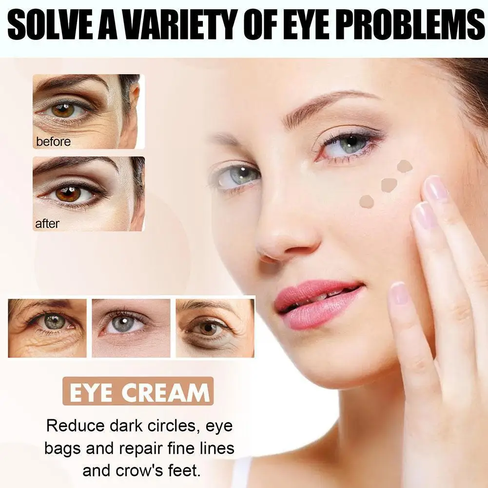 

1 мин, сыворотка для красоты глаз, быстрое снижение, сыворотка для глаз, средство для удаления темных и тонких эффектов, круг глаз C9X6