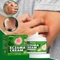 1pcs herbal skin itching antibacterial cream psoriasis cream anti itch relief eczema skin rash urticaria desquamation treatment