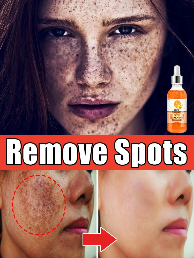 ʸ ᵒᵉ ᵉ ᵒ ˢ ᵃᵃᵃᵃᵃᵃᵃᵃ