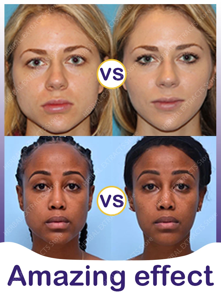 

Face Slimming Cream Whitening Eliminate Double Chin