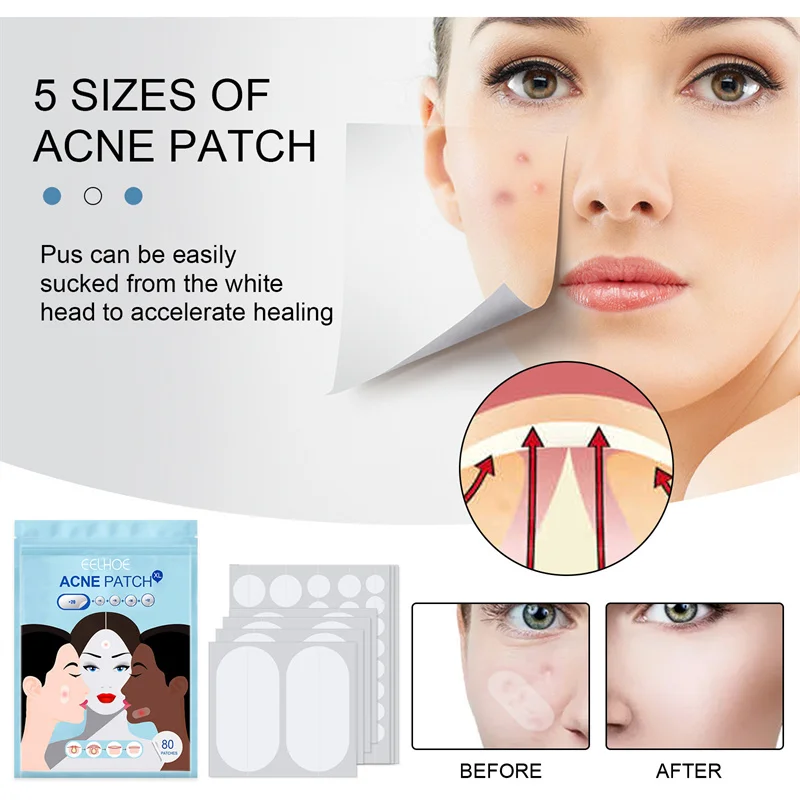 

80Pcs Acne Stickers Makeup Invisible Net Acne Stickers Anti-acne Closed Acne Waterproof Concealer Hydrocolloid Oil Acne Sticker
