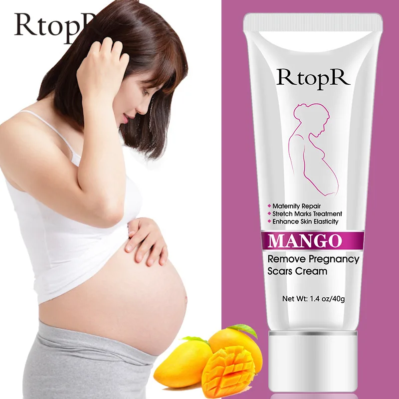 

10Pcs Mango Remove Pregnancy Scars Cream Stretch Marks Treatment Maternity Repair Anti-Aging Skin Firming Body Lotion Skincare