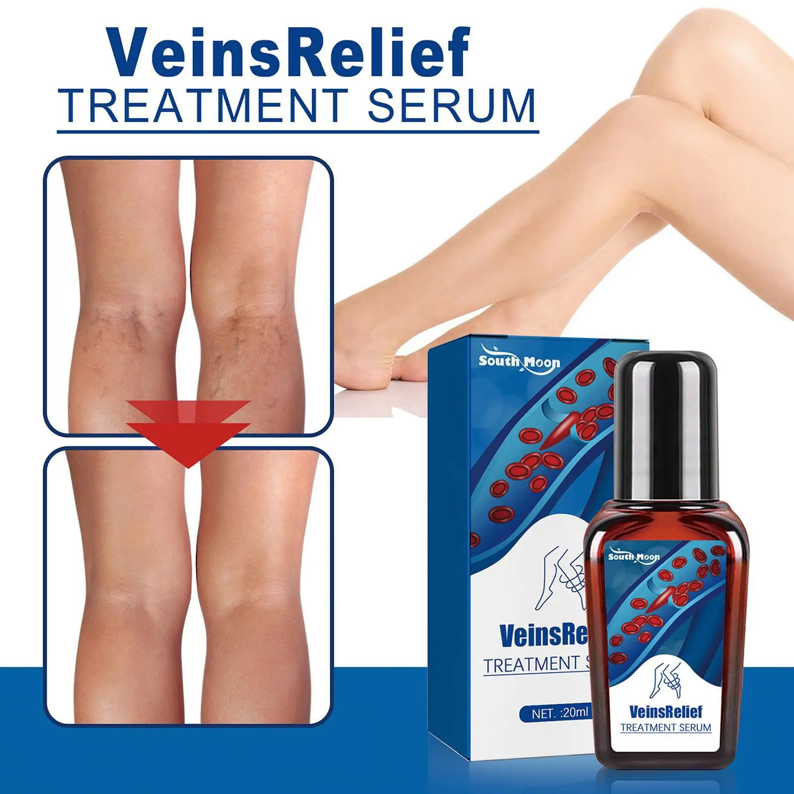 

Varicose Veins Treatment Essential Oil Relief Phlebitis Angiitis Remedy Pain Spray For Spider Veins Edema Nerve Pain Leg Pain