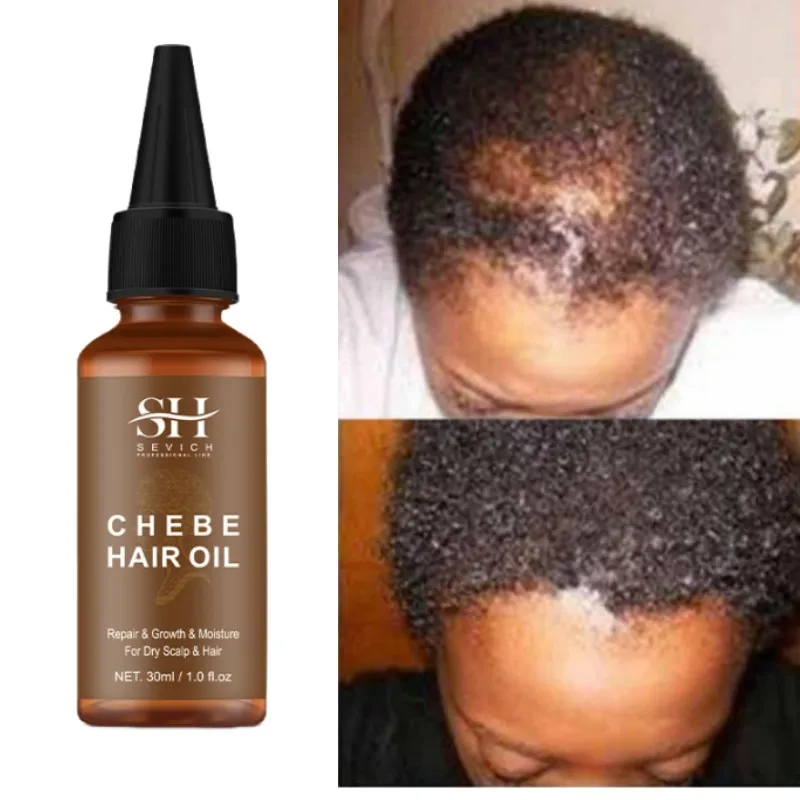 30ml Fast Hair Growth Essence Oils Anti-Hair Loss Serum Hair Thinning Treatment Spray African Chebe Crazy Hair Growth Product