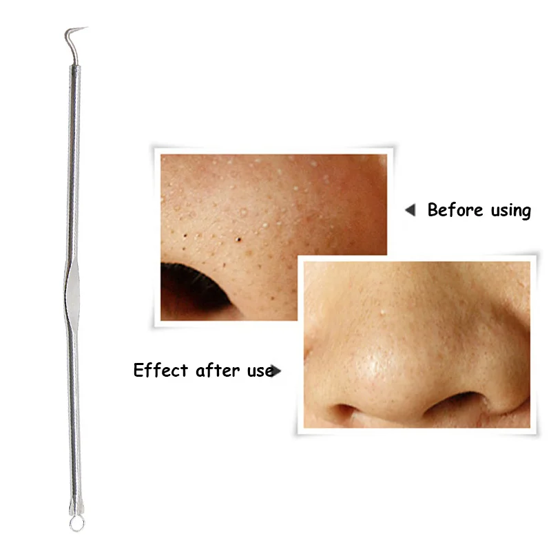 Устройство для удаления черных точек прыщей акне