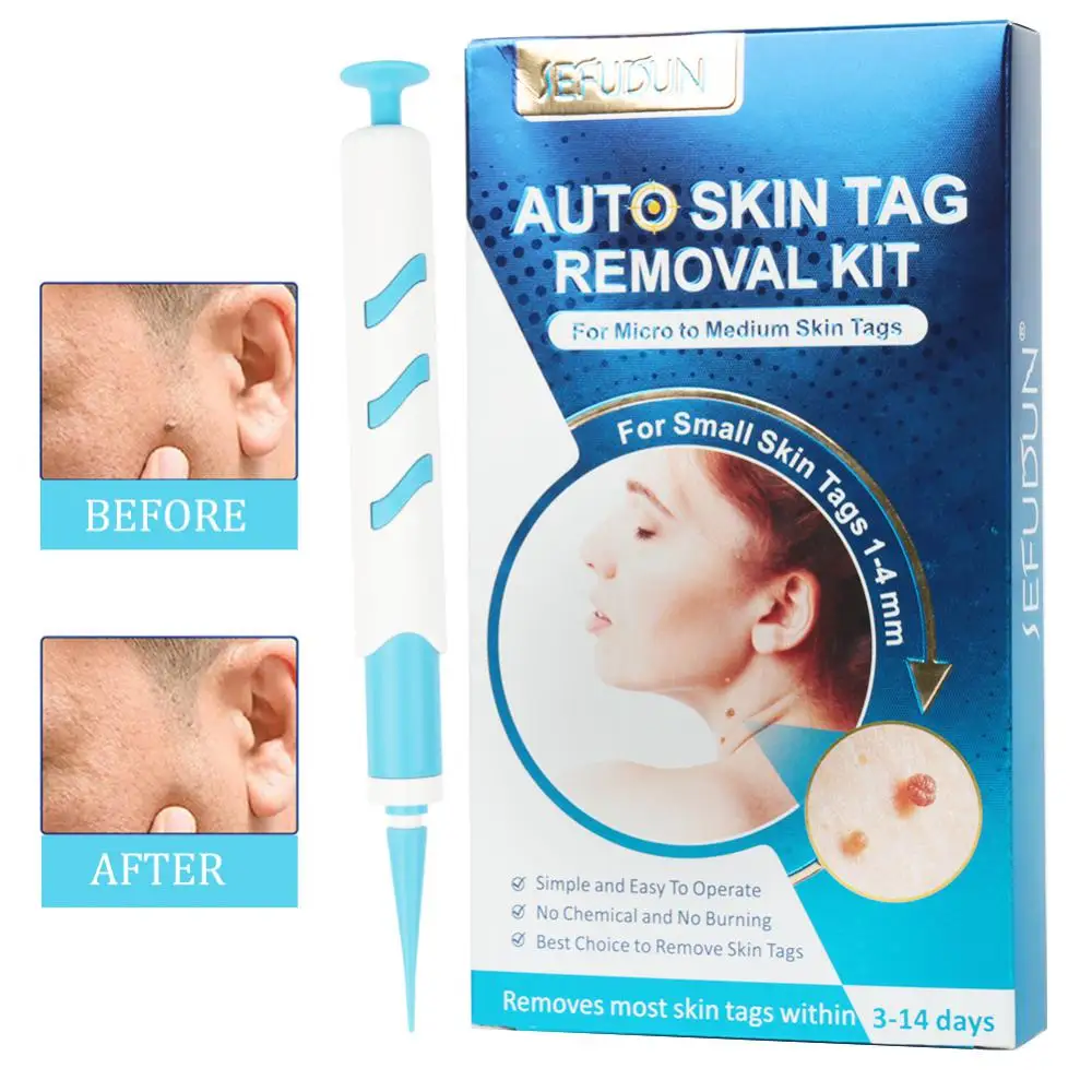 

Этикетка для удаления кожи, очищение лица, подходит для лица и тела, высококачественный набор для удаления этикеток, устройство для удаления этикеток