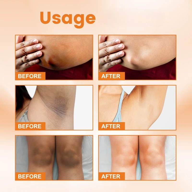 Витамин с чтобы улучшить оттенок кожи