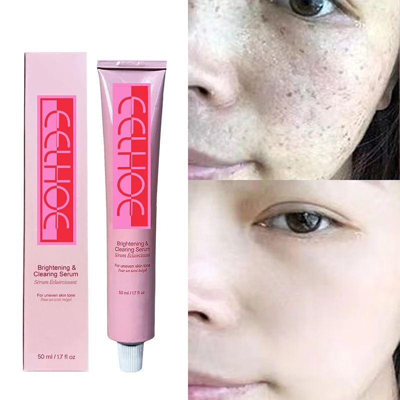 

Whitening Face Serum Remover Freckle Melasma Lightening Melanin Fade Dark Spots Essence Anti-aging Moisturizing Beauty Skin Care