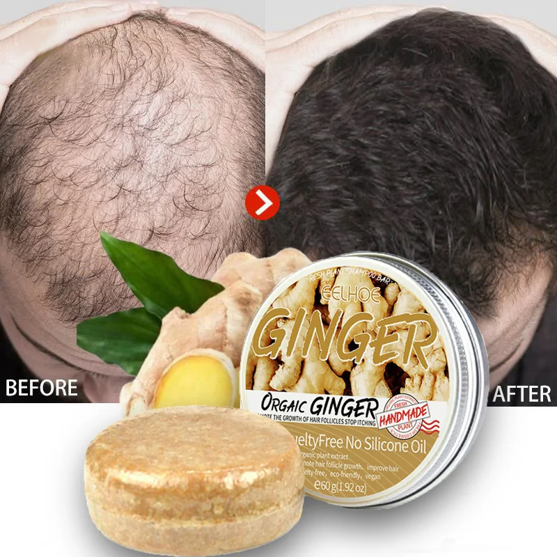 

Ginger Hair Growth Products Anti Hair Loss Soap Repair Scalp Nourishing Brighten Hair Care Prevent Hair Loss Handmade Soap 60g