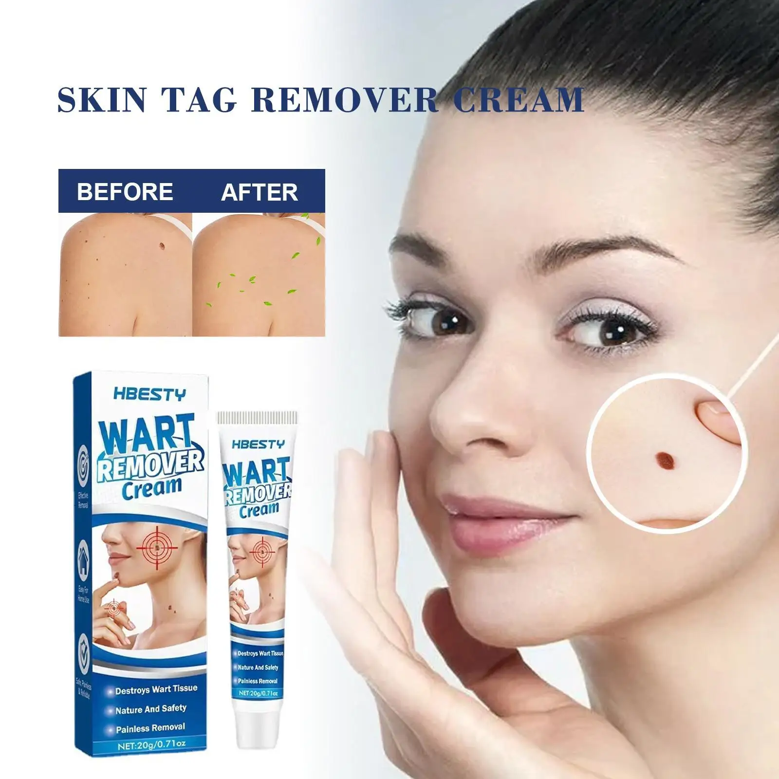 

Skin Tag Remover Cream Painless Mole Skin Dark Spot Remover Wart Oil Face Warts Treatment Removal Essential Serum Freckle T N5g2