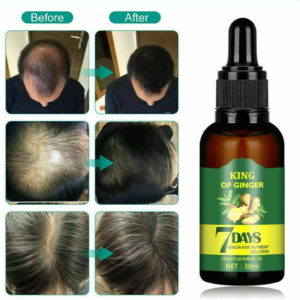 

30ml Hair Fast Growth And Hair Care Essential Oil Natural Ginger Hair Regrowth Products Serum Hair Care Hair Loss Wholesale