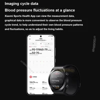 Часы Xiaomi H1#3