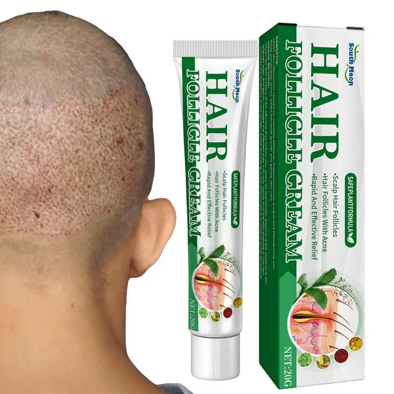 

Folliculitis Cream Scalp Hair Folliculitis Herbs Treatment Pustules Ulcers Medicine Spot Remover Skin Ointment Cysts Papules
