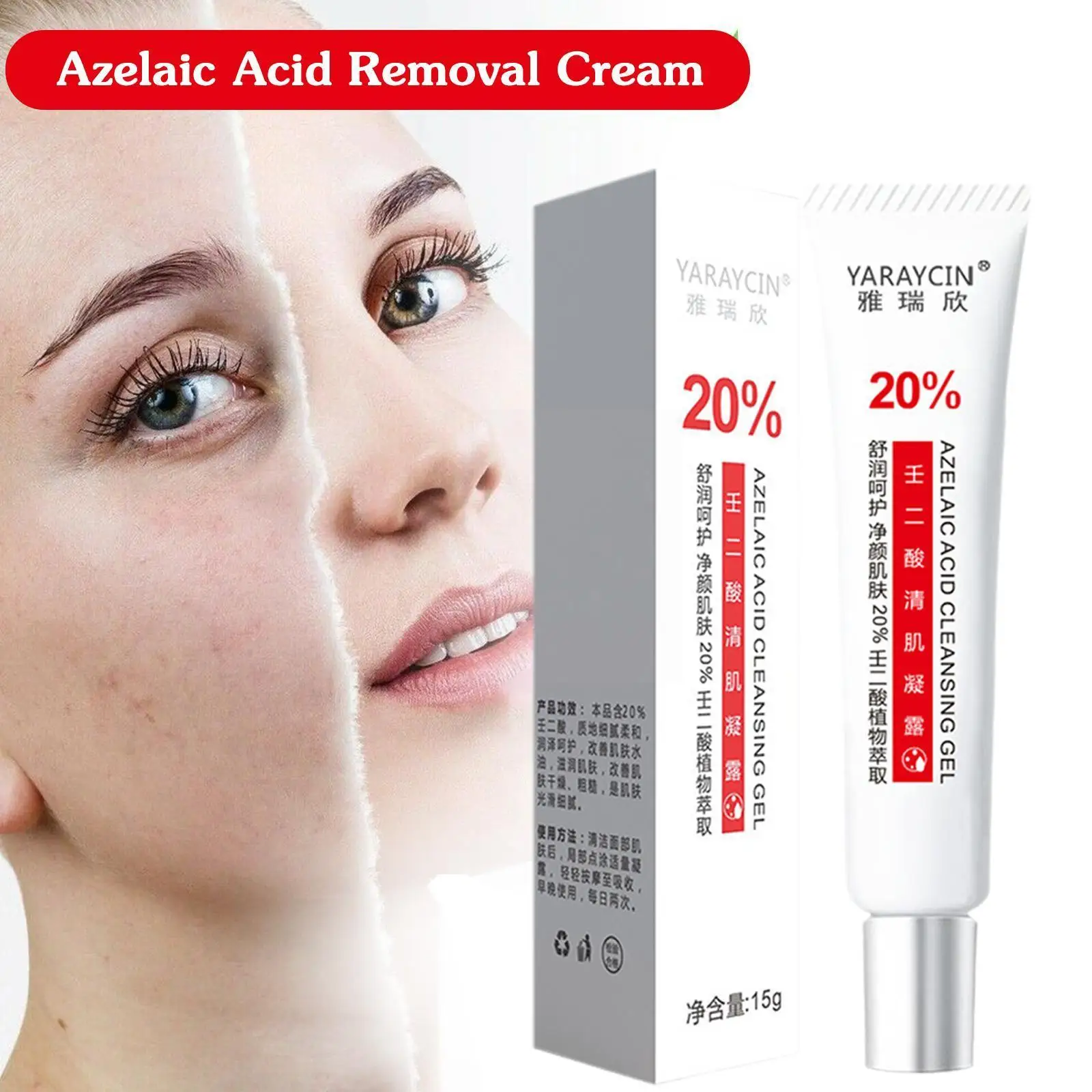 

Acne Removal Cream With Azelaic Acid 20% G5h7