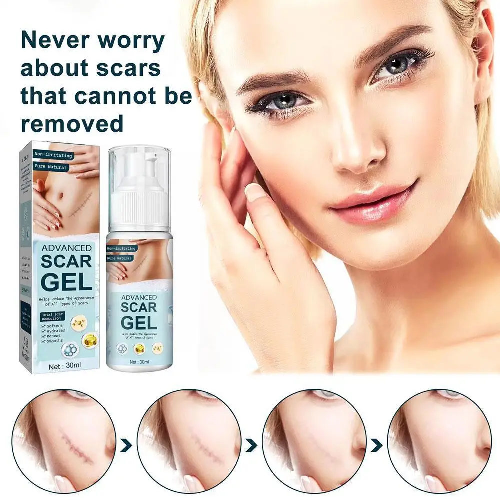 

30ml Scar Pimples Spot Gel For Acne Scars Removal Surgical Scar Stretch Marks Treatment Body Face Skin Care Beauty I3V6