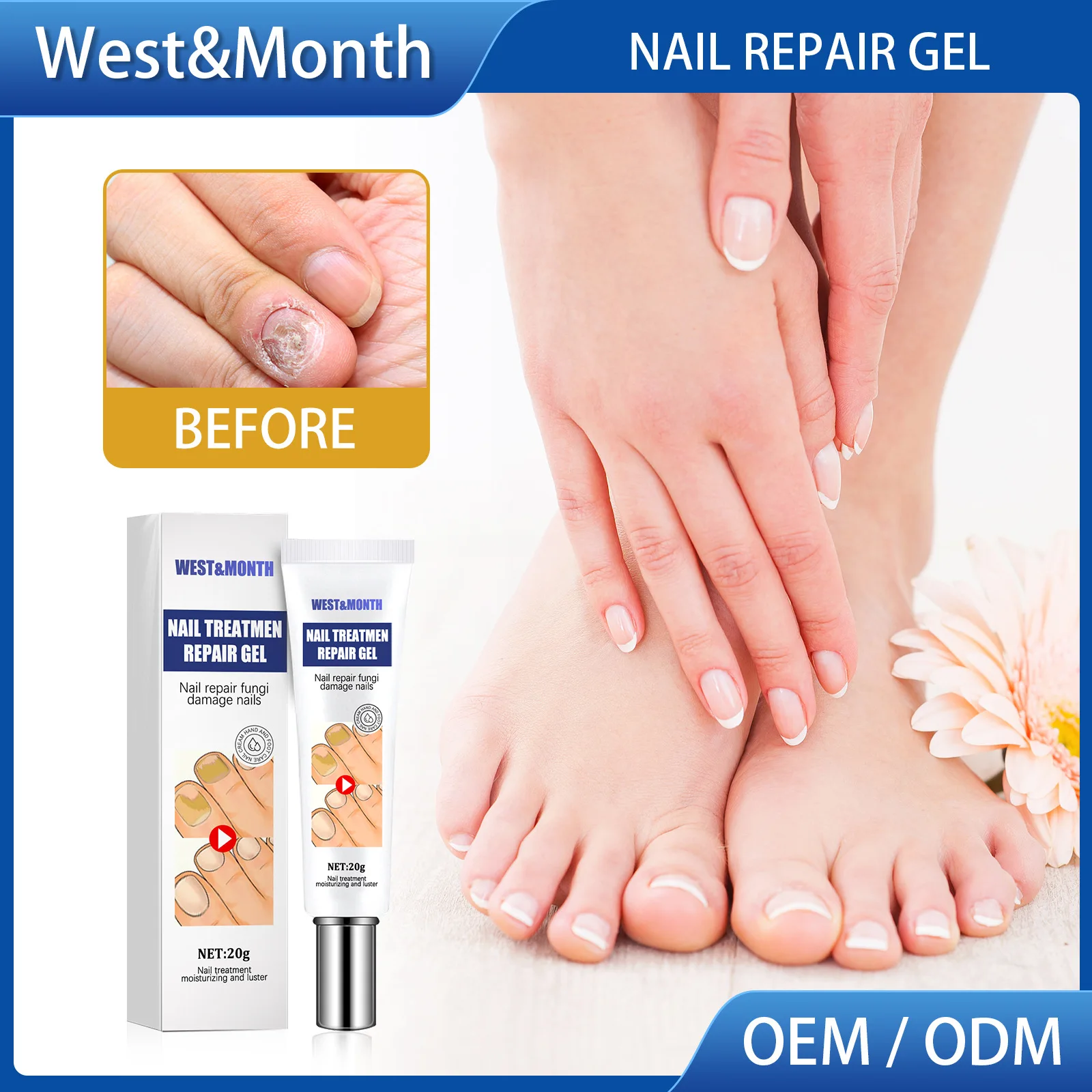 

Foot Treatment Gray Nail Curement Recover Nail-Soften Cream Nail Hand and Foot Removing Gray Nail Brightening Nail Care Cream