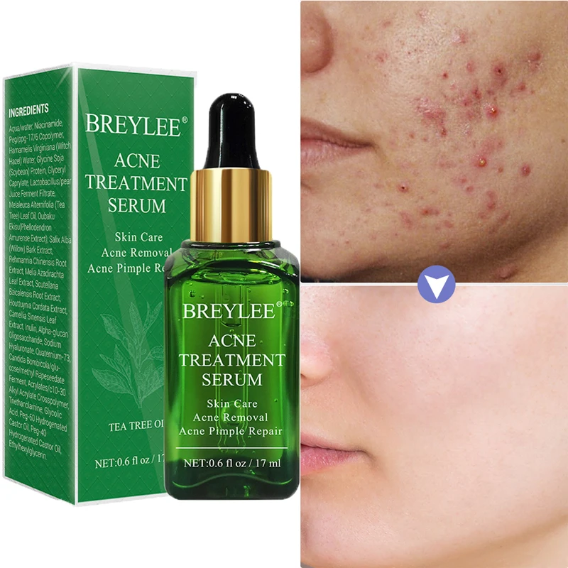 

Сыворотка для ухода за кожей лица с экстрактом чайного дерева