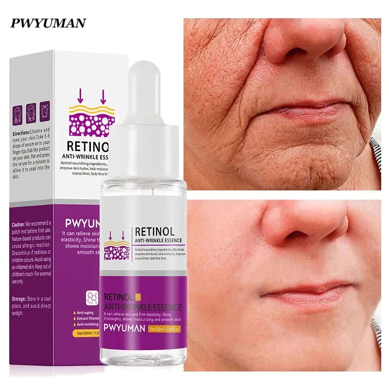 nie macierz usuń zmarszczki serum Anti-aging znikną drobne linie Lifting ujędrniający balsam wybielający nawilżający gładka pielęgnacja