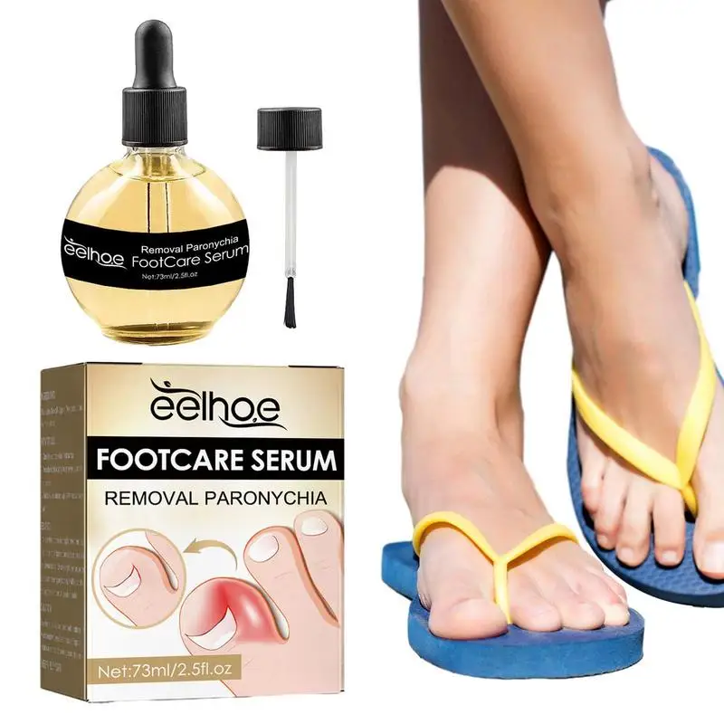 

Toenail Care Products Nail Repair Toenail Care Essence Improve Toenail Health Anti Paronychia Oil Relief For Women