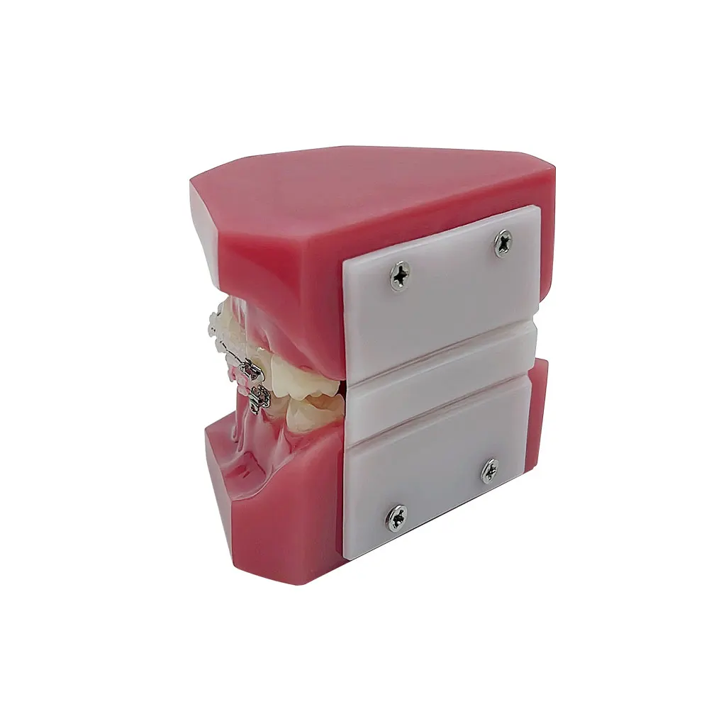 Обычная ортодонтическая стоматологическая обучающая модель с