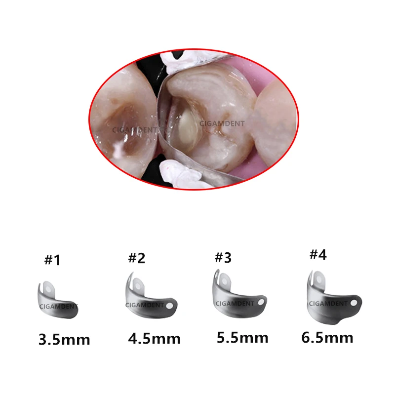 Стоматологические матричные ленты Palodent V3 стильные секционные контурные клинья