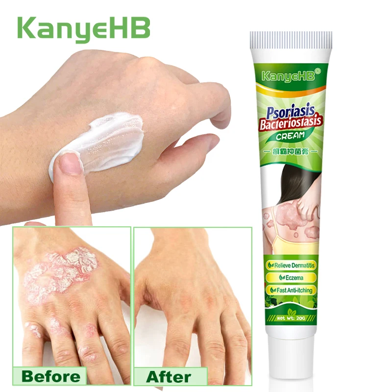 

1Pcs Herbal Eczema Cream Chinese Medicine Dermatitis Psoriasis Rash Treatment Ointment Skin Anti-Itch Health Care Plaster G024