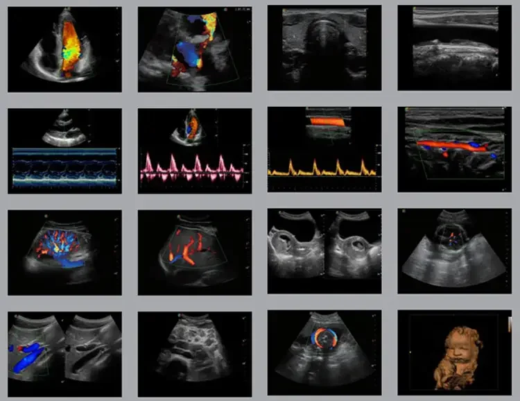 Портативный ультразвуковой сканер медицинские ультразвуковые инструменты от