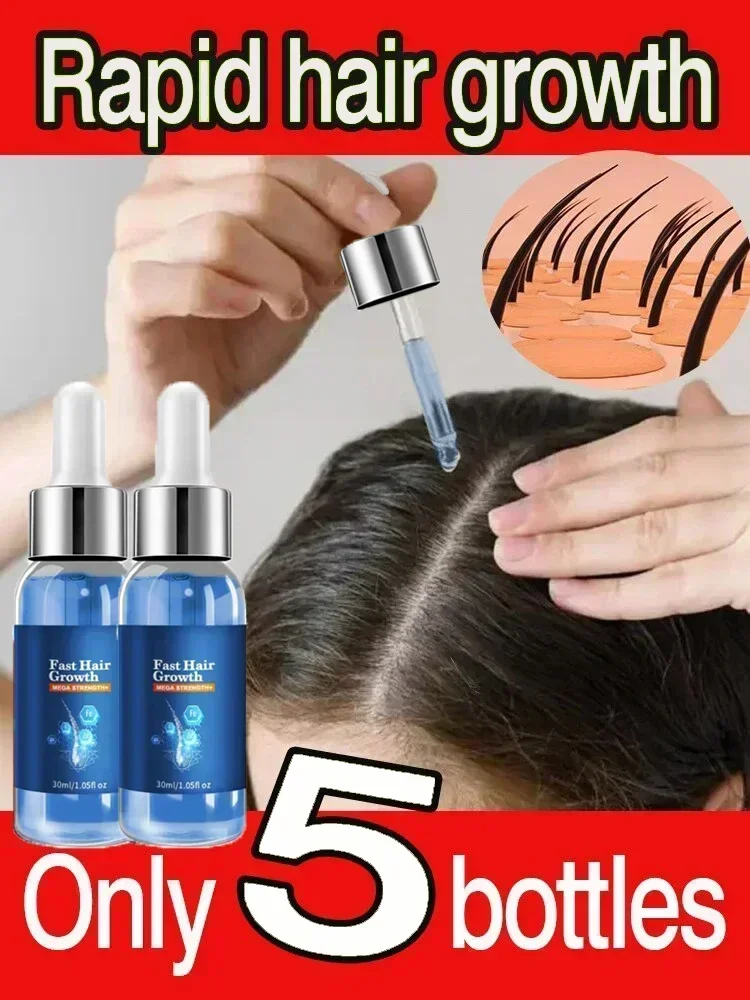 Имбирное натуральное масло для массажа волос уход за волосами выпадение