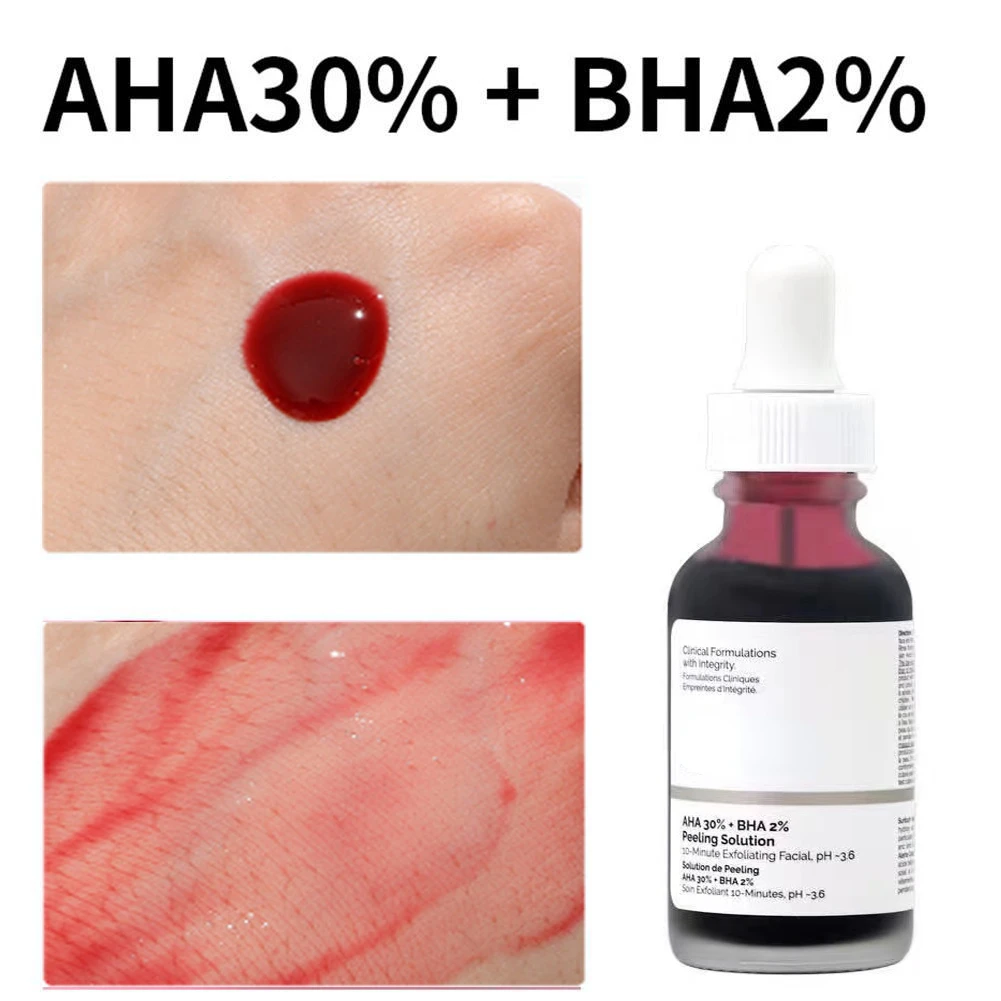 

Средство для пилинга лица AHA 30% + BHA 2%, сыворотка для удаления акне, восстановление, уход за кожей лица с гиалуроновой кислотой, 30 мл