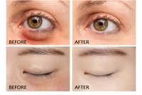 vitamin vc eye essence 20ml replenish water moisturize brighten skin moisturize tighten wrinkle anti aging and remove acne