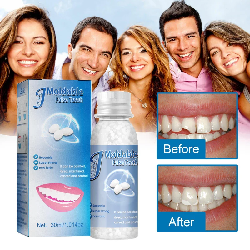 

Temporary Filling Teeth Glue False Filling Cavity Broken Teeth Teeth Gap Filling Solid Glue Particles Can Be Shaped Teeth Glue