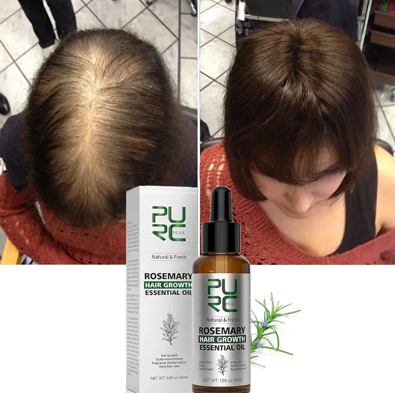 

Original PURC Rosemary Oil Hair Growth Products for Man Women Ginger Anti Hair Loss Fast Regrowth Thicken Oils Scalp Treatment