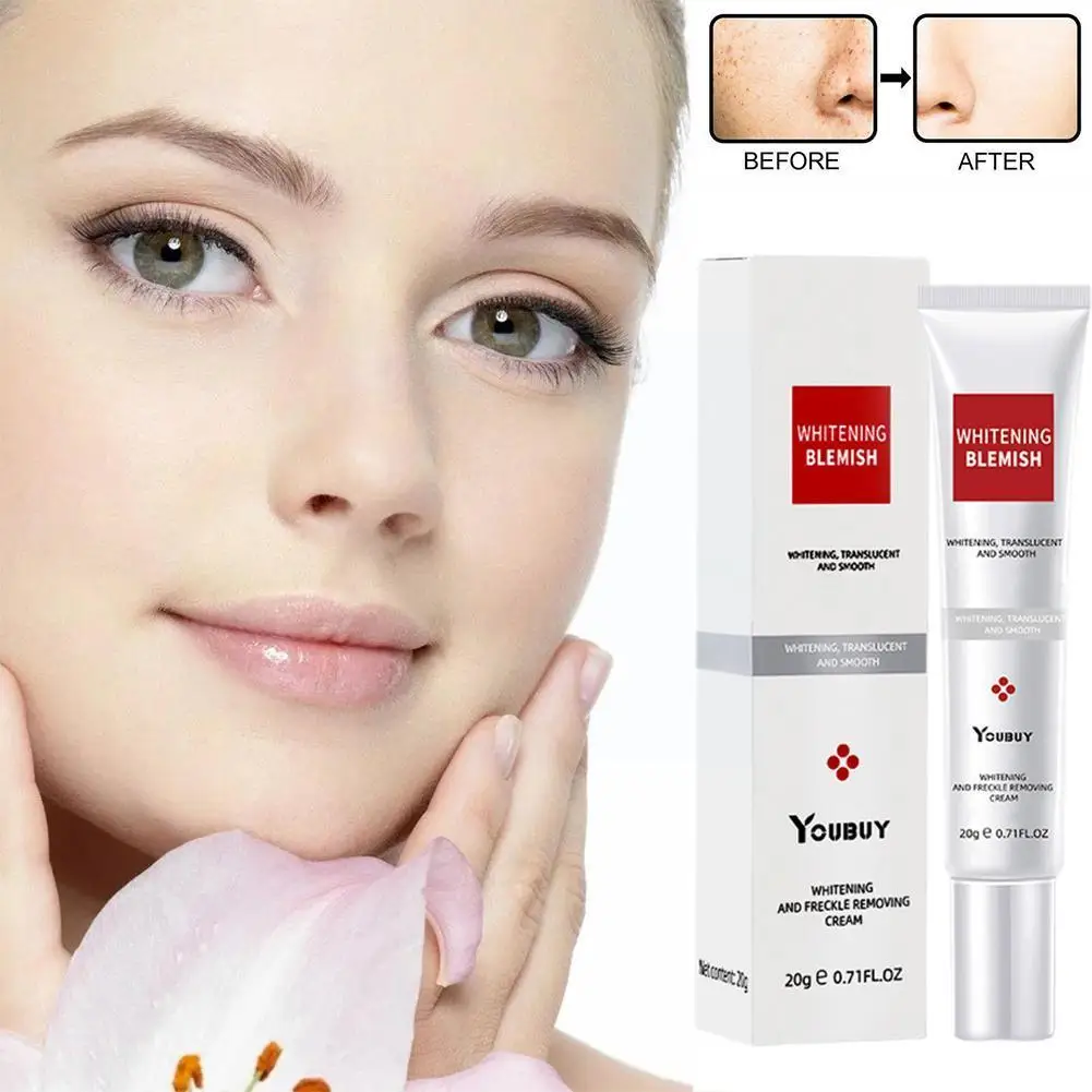 

Freckle Removal Cream Whitening Effective Melasma Removal Firm Cream Extract Moisturizing Skin Whitening Lifting Plant Hydr H7F4