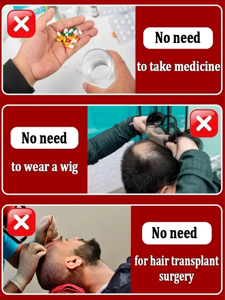 Масло для роста волос эффективный восстановление облысения гегентическое