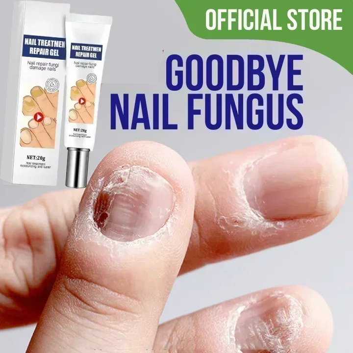 ГОРЯЧАЯ ПРОДАЖА восстановление грибка ногтей ремонт для обесцвеченных