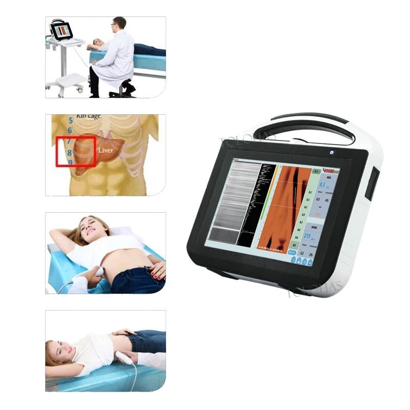 LHAULS Ультразвуковое устройство для эластиграфии HBV неинвазивный детектор