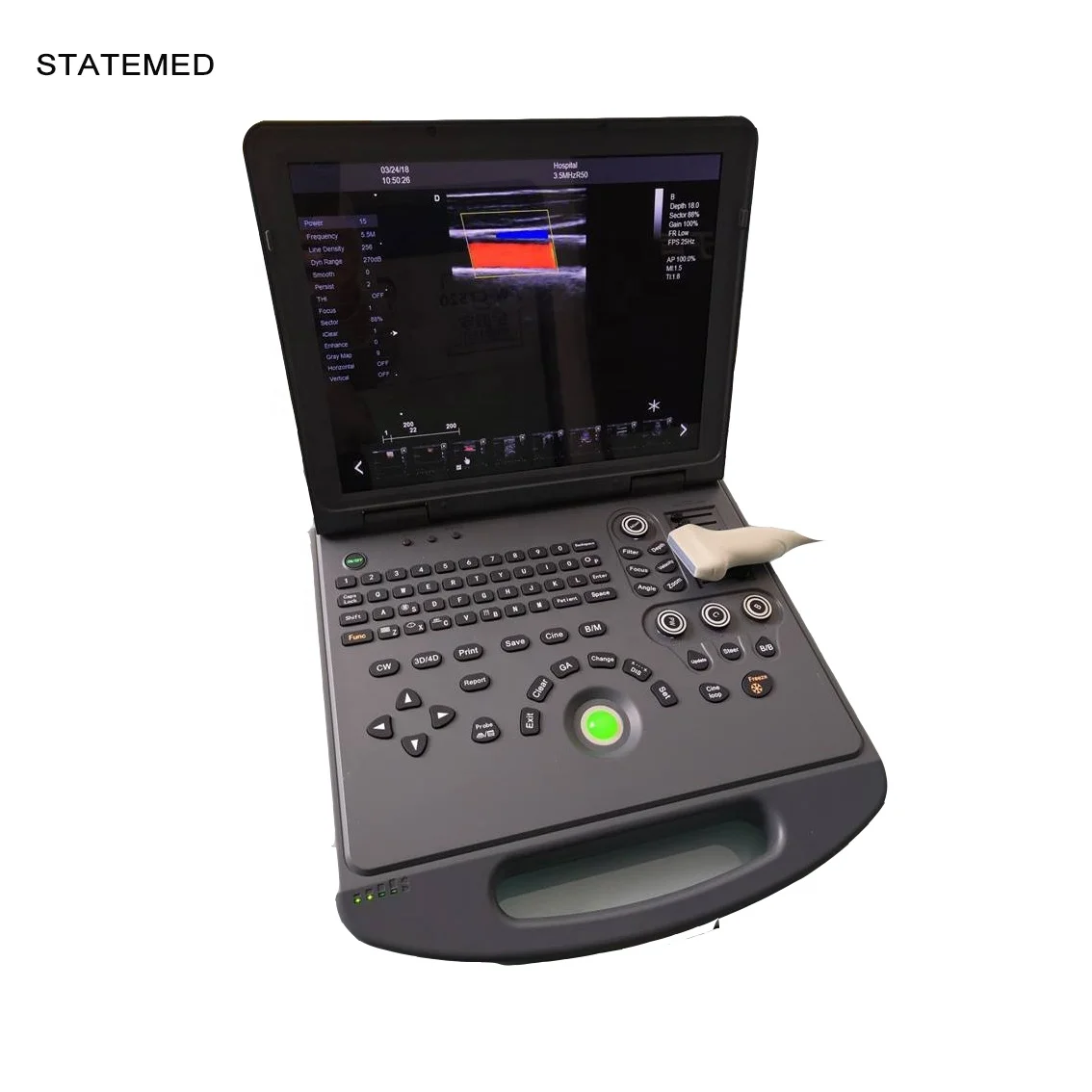 

3D/4D Portable color doppler ultrasound Machine Ultrasound Scanner