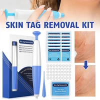 new tag remover kits face auto band skin care beauty tools wart remove acne pimple blemish treatments with 40pcs rubber bands