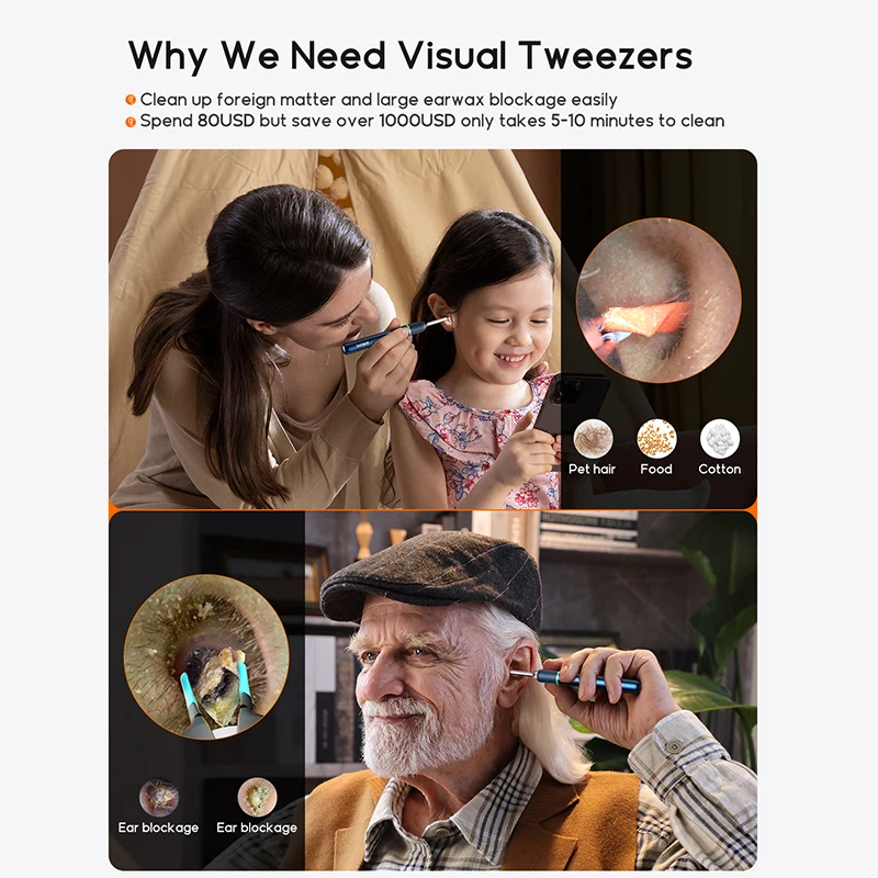 Трендовый продукт 2024 Лидер продаж пинцет Bebird Note 5 Pro средство для чистки ушей с HD