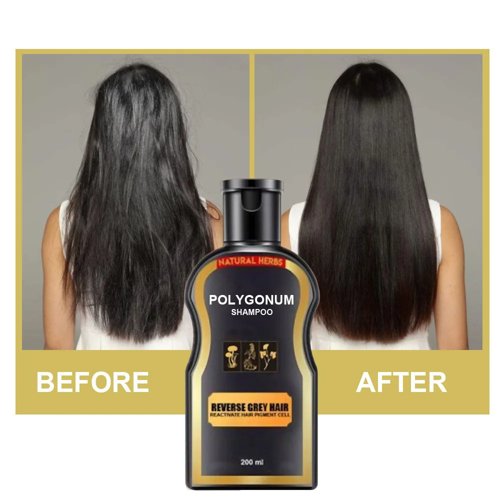 

Natural Polygonum Multiflorum Shampoo For Dandruff And Itching To Promote Hair Growth For Hair Darkening For Hair Care Styling