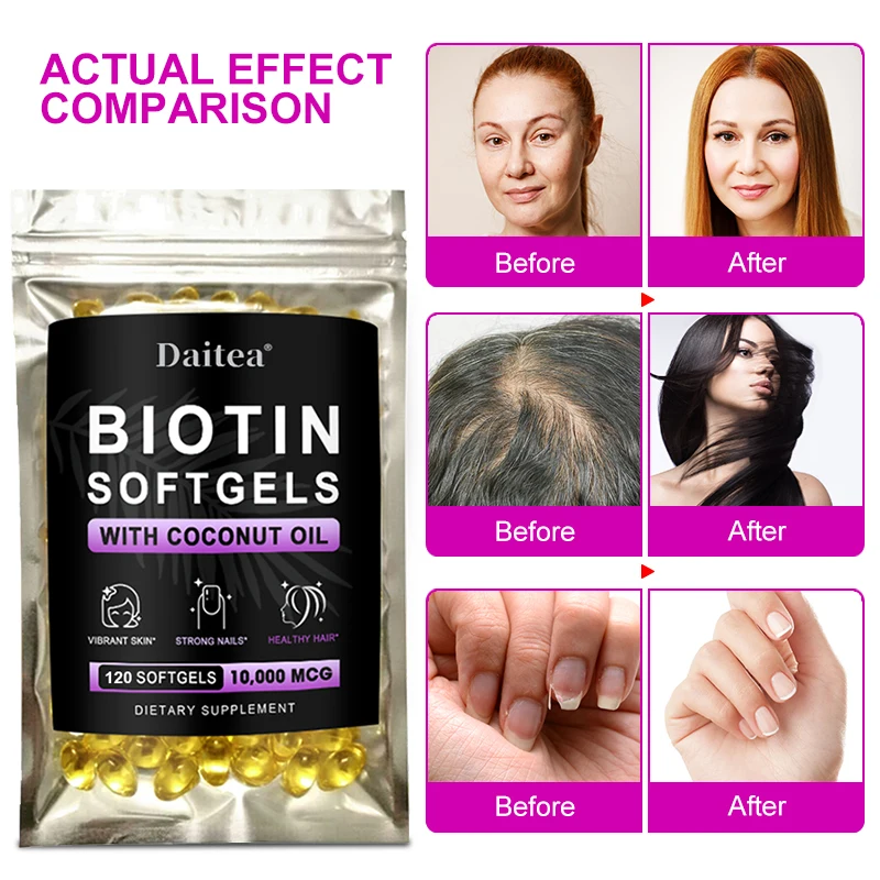 

Supplement Vitamins for Anti-aging,Help Hair Growth, Nails, Skin Health and Luster,Adult Biotin Capsules Promote Metabolism