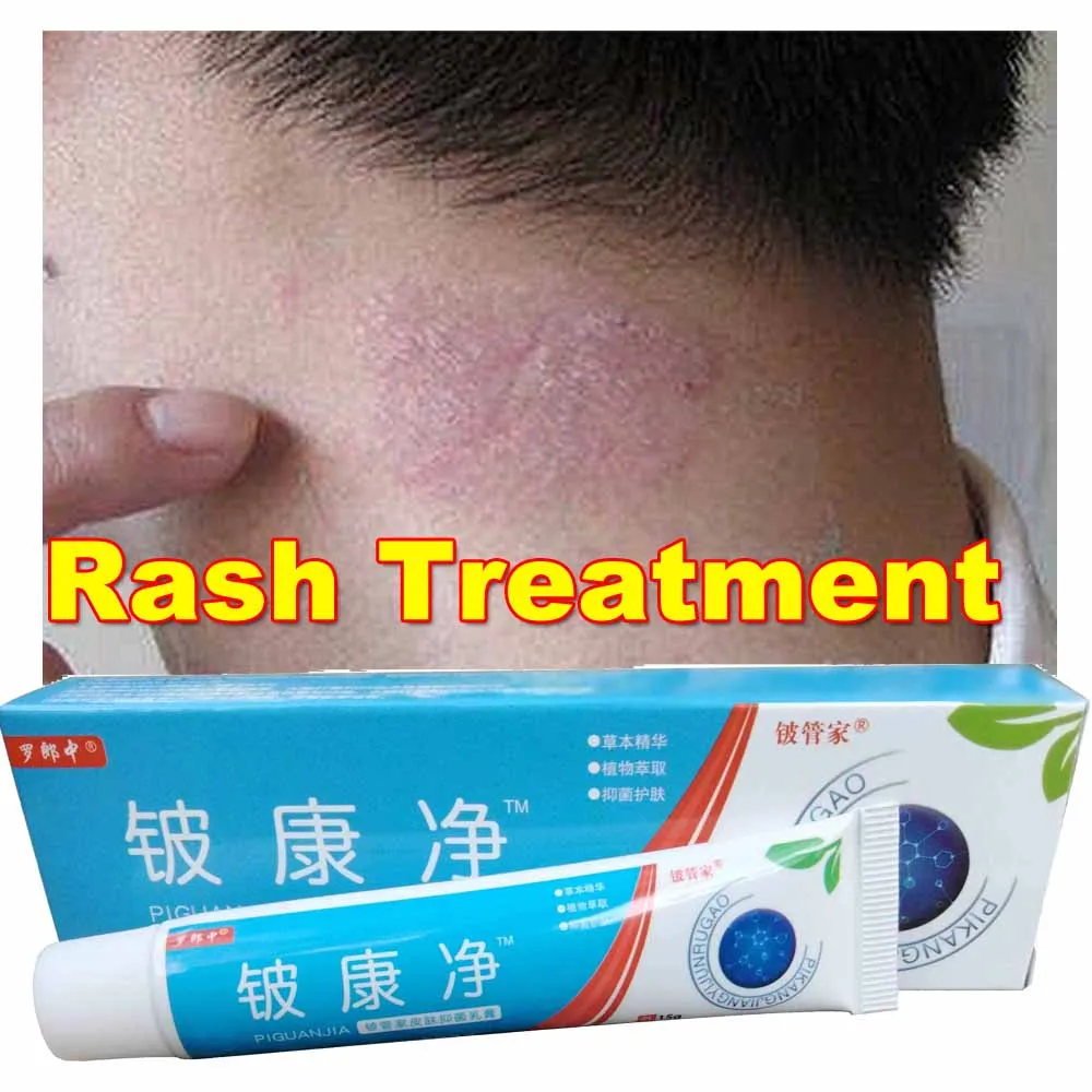 

Treatment Psoriasis Ointment Dermatitis Skin Eczema Blister Natural Chinese Herbal Creams Pruritus PKJ
