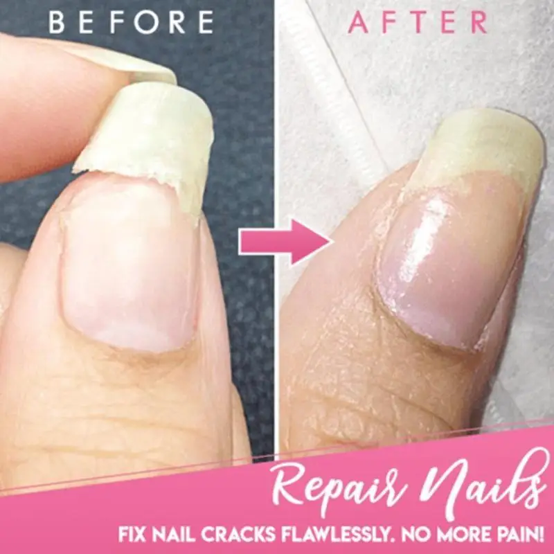 

5ml Cracked Nail Repair Gel Polish Soak Off Extension Uv Gel High Hardness Extend Repairing Broken Nails For Nail Art Gel X2w0