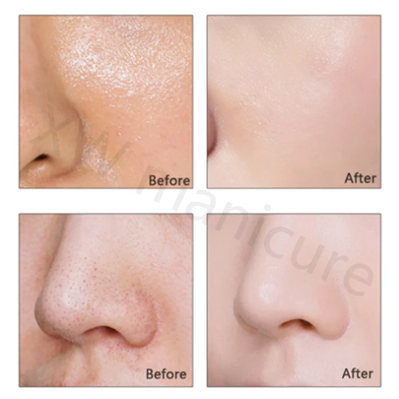 Рисунок 5 - Составная кислота