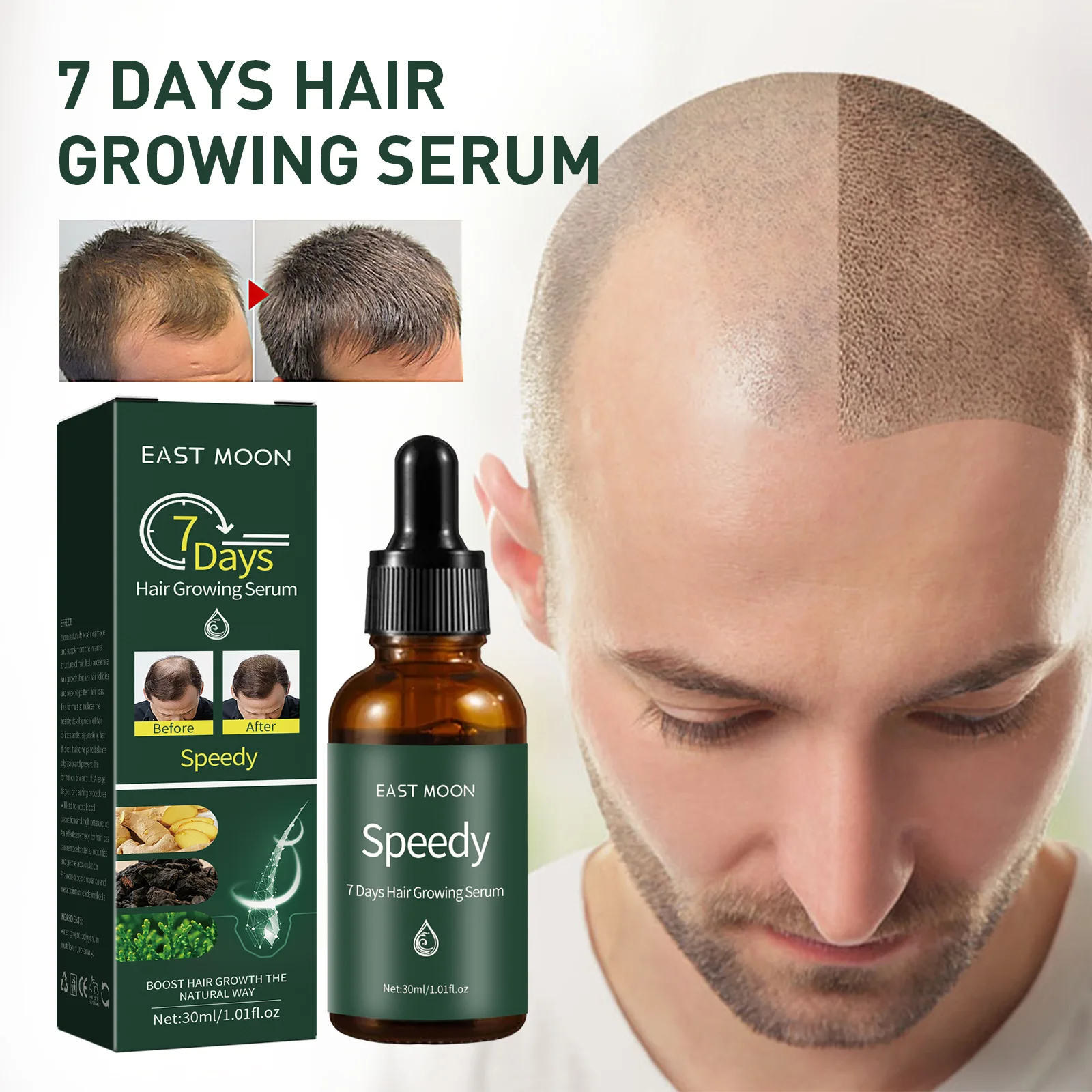 

Sdotter 7 Days Fast Growth Repair Serum Thickening Hair Hair Loss Solution Anti Hair Loss Treatment Volume For Men Women 2023 Ne