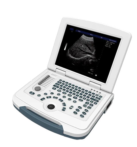 

ultrasound machine price portable ultrasound machine