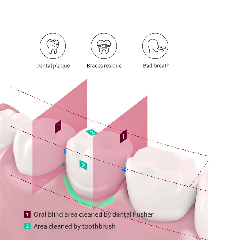 Ирригатор полости рта портативный 3 режима 5 насадок 200 мл | Бытовая техника