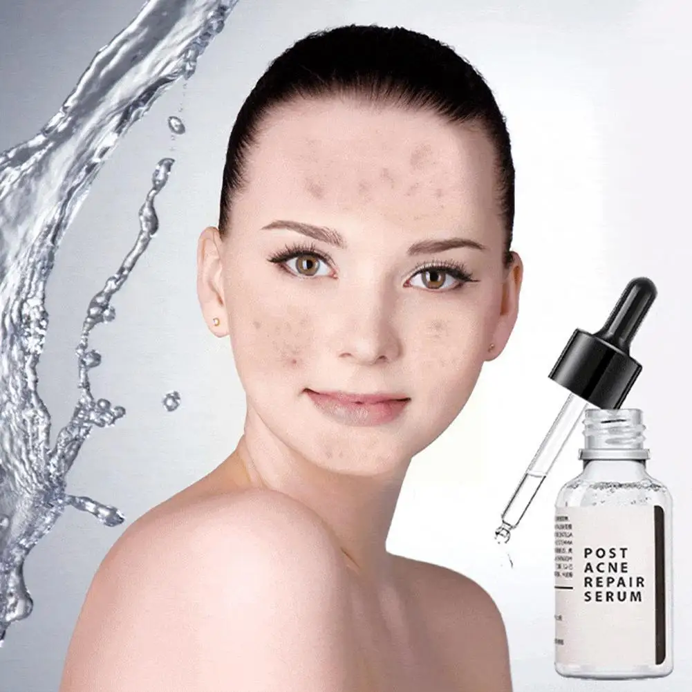 

30ml Salicylic Acid 2% Solution Removes Acne Face Serum Brighten Spot Essence Fade Skin Moisturizing Shrinks Care Face Pore R8k6
