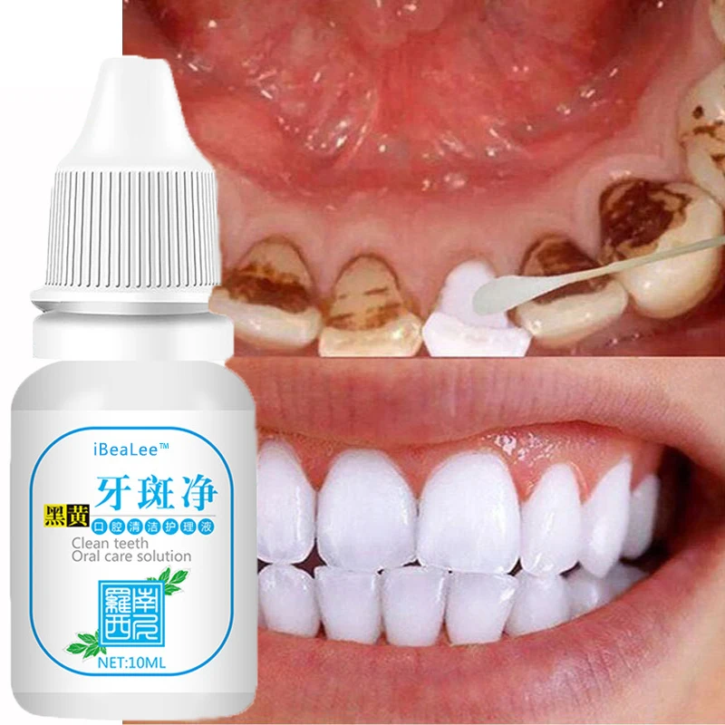 Teeth Whitening Essence Remove Stains Dental Bleach Fresh Breath Oral Hygiene Cleansing Serum Gum Protection Tartar Remover Gel